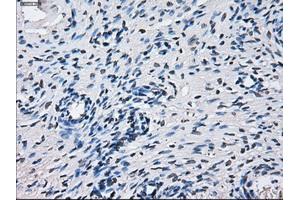 Immunohistochemical staining of paraffin-embedded Ovary tissue using anti-CYP2E1 mouse monoclonal antibody. (CYP2E1 antibody)