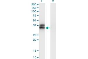 Western Blot analysis of OLIG2 expression in transfected 293T cell line by OLIG2 monoclonal antibody (M05), clone 2A8. (OLIG2 antibody  (AA 2-78))