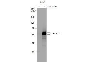 WB Image BMPR1B antibody detects BMPR1B protein by western blot analysis. (BMPR1B antibody)