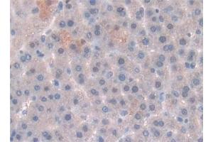 Detection of LEP in Rat Liver Tissue using Polyclonal Antibody to Leptin (LEP) (Leptin antibody  (AA 22-167))