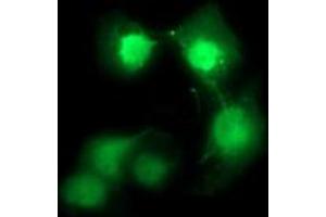 Image no. 2 for anti-Cell Division Cycle 123 Homolog (CDC123) antibody (ABIN1497388) (CDC123 antibody)