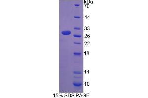 SDS-PAGE (SDS) image for Ureidopropionase, beta (UPB1) (AA 154-393) protein (His tag) (ABIN4989377)