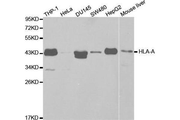 HLA-A antibody  (AA 35-285)