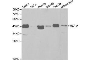 Western blot analysis of extracts of various cell lines, using HLA-A antibody. (HLA-A antibody  (AA 35-285))