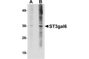 Western Blotting (WB) image for anti-ST3 beta-Galactoside alpha-2,3-Sialyltransferase 6 (ST3GAL6) (C-Term) antibody (ABIN1030700) (ST3GAL6 antibody  (C-Term))