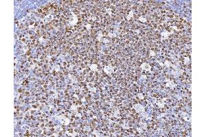 IHC analysis of MCM6 using anti-MCM6 antibody (ABIN7600035).