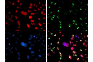 Immunofluorescence (IF) image for anti-Recombination Activating Gene 2 (RAG2) antibody (ABIN1876827)