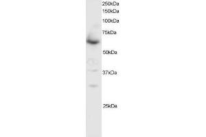 Image no. 1 for anti-SMAD Family Member 4 (SMAD4) (C-Term) antibody (ABIN374104)