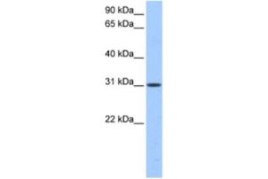 Western Blotting (WB) image for anti-HUS1 Checkpoint Homolog B (HUS1B) antibody (ABIN2463539) (HUS1B antibody)