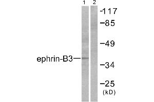 Western blot analysis of extracts from SKOV3 cells, using Ephrin-B3 antibody (#C0182).