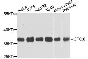 Western blot analysis of extracts of various cell lines, using CPOX antibody.