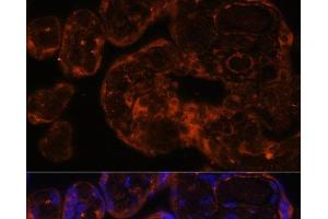 Immunofluorescence analysis of Human placenta using Factor IX / F9 Polyclonal Antibody at dilution of 1:100 (40x lens). (Coagulation Factor IX antibody)