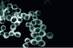 Immunofluorescence staining of PC12 cells (Rat neuroblastoma, ATCC CRL-1721) treated with NGF. (GNAQ antibody  (AA 22-31))