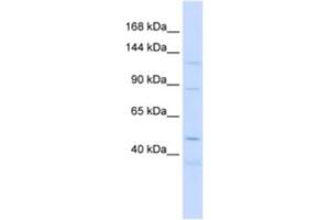 Western Blotting (WB) image for anti-Sterol Regulatory Element Binding Transcription Factor 2 (SREBF2) antibody (ABIN2463718) (SREBF2 antibody)