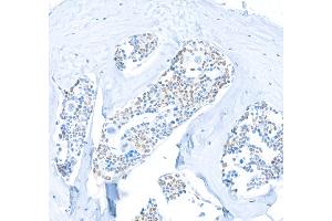 Immunohistochemistry (IHC) image for anti-Spleen Focus Forming Virus (SFFV) Proviral Integration Oncogene Spi1 (SPI1) (AA 220-270) antibody (ABIN7455166)
