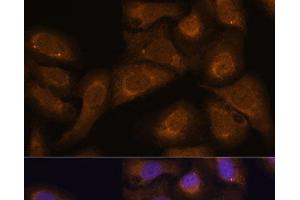 Immunofluorescence analysis of U-2 OS cells using STAR Polyclonal Antibody at dilution of 1:100 (40x lens). (STAR antibody)