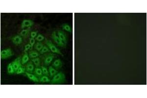Immunofluorescence analysis of A549 cells, using CSRL1 Antibody. (VN2R1P antibody  (AA 400-449))
