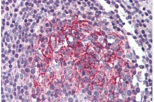 Human Small Intestine, Peyer's Patch (formalin-fixed, paraffin-embedded) stained with IL1R2 antibody ABIN214353 at 10 ug/ml followed by biotinylated goat anti-rabbit IgG secondary antibody ABIN481713, alkaline phosphatase-streptavidin and chromogen. (IL1R2 antibody)