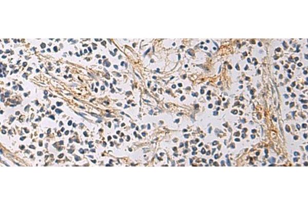 GMPR antibody