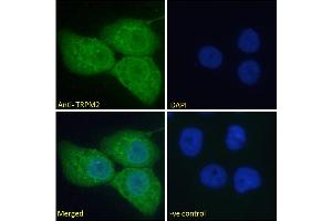 ABIN6391352 Immunofluorescence analysis of paraformaldehyde fixed A431 cells, permeabilized with 0. (TRPM2 antibody  (Internal Region))
