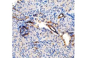 IHC analysis of CD31/Pecam1 using anti-CD31/Pecam1 antibody (ABIN7601662).