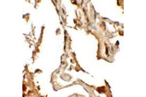 Immunohistochemistry of RLP2 in human lung tissue with RLP2 antibody at 2. (RILPL2 antibody  (Middle Region))