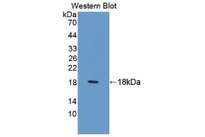 Western blot analysis of the recombinant protein. (LAMB2 antibody  (AA 1178-1311))
