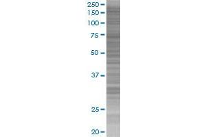 PDGFRA transfected lysate. (PDGFRA 293T Cell Transient Overexpression Lysate(Denatured))
