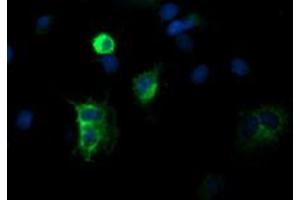 Image no. 4 for anti-Differentially Expressed in FDCP 6 Homolog (DEF6) antibody (ABIN1497809)