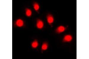 Immunofluorescent analysis of Rpb1 CTD (pSer5) staining in HeLa cells. (Rpb1 CTD antibody  (C-Term, pSer5))
