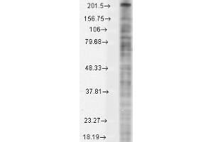 Nav1 8 Cos1 8 transient Western Blotting. (Nav1.8 antibody  (AA 1724-1956))