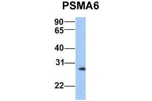 Host:  Rabbit  Target Name:  PSMA6  Sample Type:  Human Hela  Antibody Dilution:  1. (PSMA6 antibody  (N-Term))