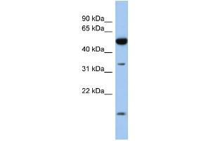 WB Suggested Anti-RDH12 Antibody Titration: 0. (RDH12 antibody  (Middle Region))