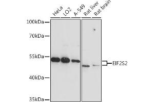 anti-Eukaryotic Translation Initiation Factor 2, Subunit 2 Beta, 38kDa (EIF2S2) (AA 1-175) antibody
