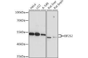 Western blot analysis of extracts of various cell lines, using EIF2S2 Rabbit pAb  at 1:3000 dilution. (EIF2S2 antibody  (AA 1-175))