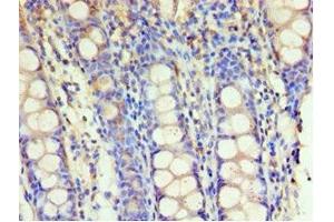 Immunohistochemistry of paraffin-embedded human colon tissue using ABIN7154112 at dilution of 1:100 (GSTM4 antibody  (AA 1-218))