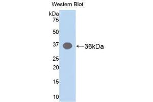 Western blot analysis of the recombinant protein. (ARG antibody)