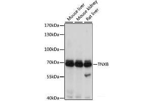 Western blot analysis of extracts of various cell lines using TNXB Polyclonal Antibody at dilution of 1:1000. (TNXB antibody)