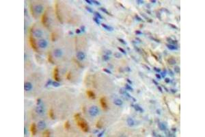 IHC-P analysis of Liver tissue, with DAB staining. (CD79a antibody  (AA 30-193))