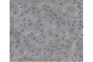 Detection of REN in Human Liver using Polyclonal Antibody to Renin (REN) (Renin antibody  (AA 67-153))