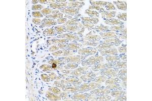 Immunohistochemistry of paraffin-embedded mouse stomach using IL6 antibody at dilution of 1:100 (40x lens).