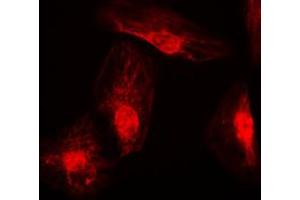 Immunofluorescent analysis of RANBP6 staining in K562 cells. (RANBP6 antibody  (Center))