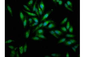 Immunofluorescence staining of Hela cells with ABIN7159428 at 1:100, counter-stained with DAPI. (Mesothelin antibody  (AA 37-598))