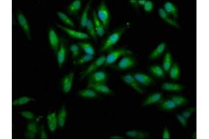 Immunofluorescence staining of Hela cells with ABIN7159428 at 1:100, counter-stained with DAPI.