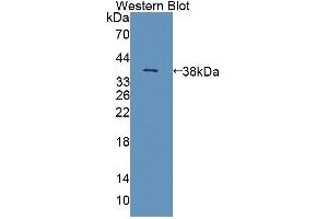 Detection of Recombinant NCR2, Human using Polyclonal Antibody to Natural Cytotoxicity Triggering Receptor 2 (NCR2) (NKp44/NCR2 antibody  (AA 22-120))