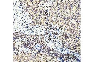IHC analysis of DDX1 using anti-DDX1 antibody (ABIN7602050). (DDX1 antibody  (AA 562-740))