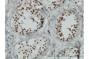 Immunoperoxidase of monoclonal antibody to TLK1 on formalin-fixed paraffin-embedded human testis. (TLK1 antibody  (AA 111-230))