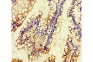 Immunohistochemistry of paraffin-embedded human small intestine tissue using ABIN7163928 at dilution of 1:100 (KCNK16 antibody  (AA 259-309))