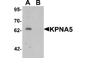 Western blot analysis of KPNA6 in EL4 cell lysate with KPNA5 antibody at 1 µg/mL in (A) the absence and (B) the presence of blocking peptide. (KPNA5 antibody  (N-Term))