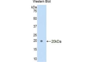 Western blot analysis of the recombinant protein. (FAM132A antibody  (AA 92-241))